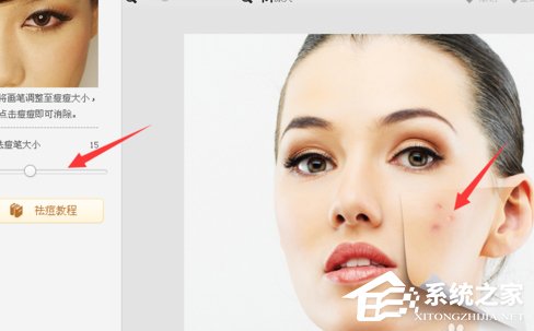 美圖秀秀怎么去除痘痘?美圖秀秀去除痘痘的方法