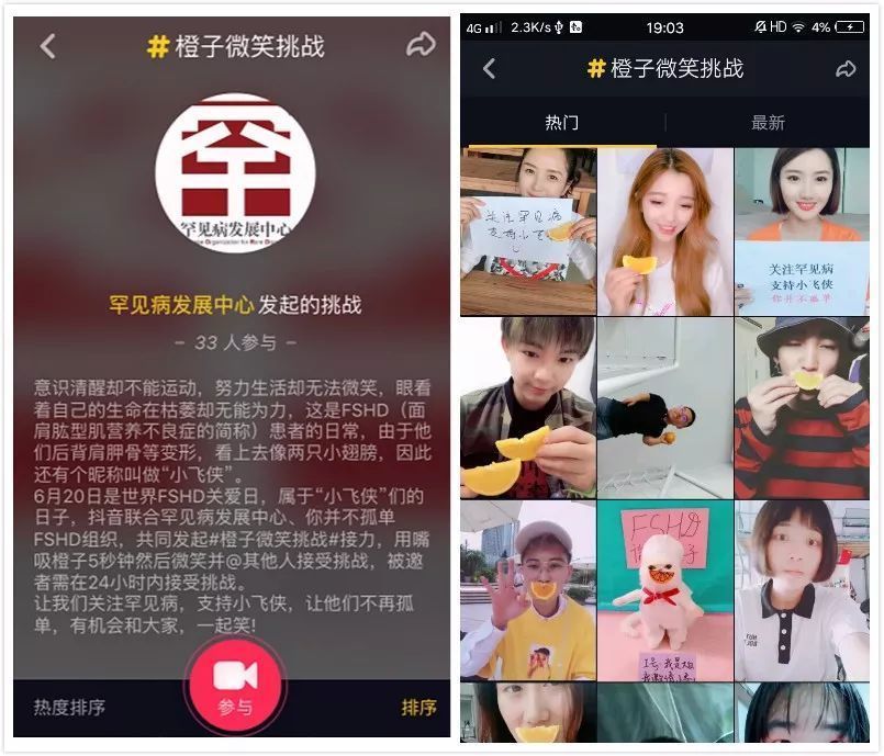 【抖音小飛俠是什么意思】小飛俠是什么病？橙子微笑挑戰(zhàn)如何參加